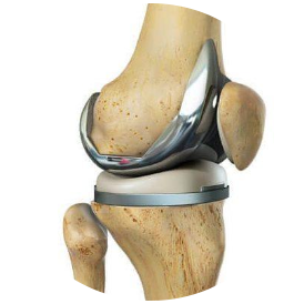 Orthopedic treatment